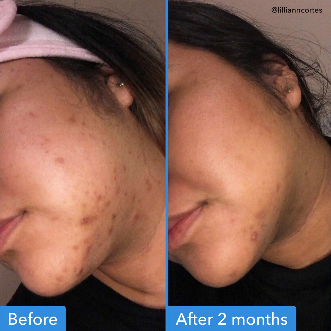 discoloration-correcting-serum-t0 zb_p.jpg