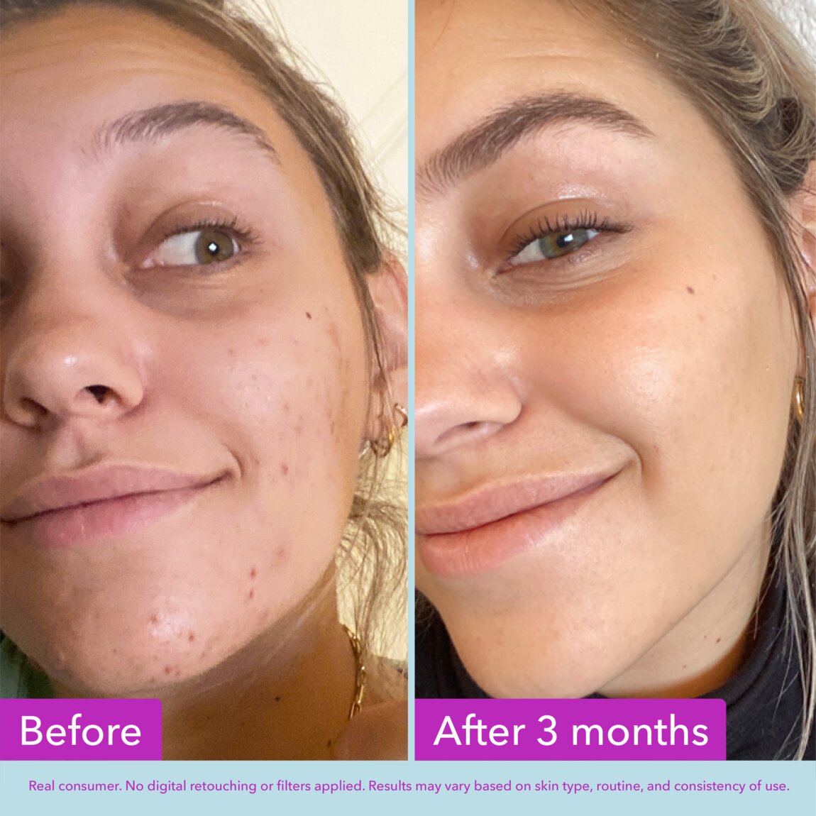niacinamide-brightening-toner-b2 zb_p.jpg