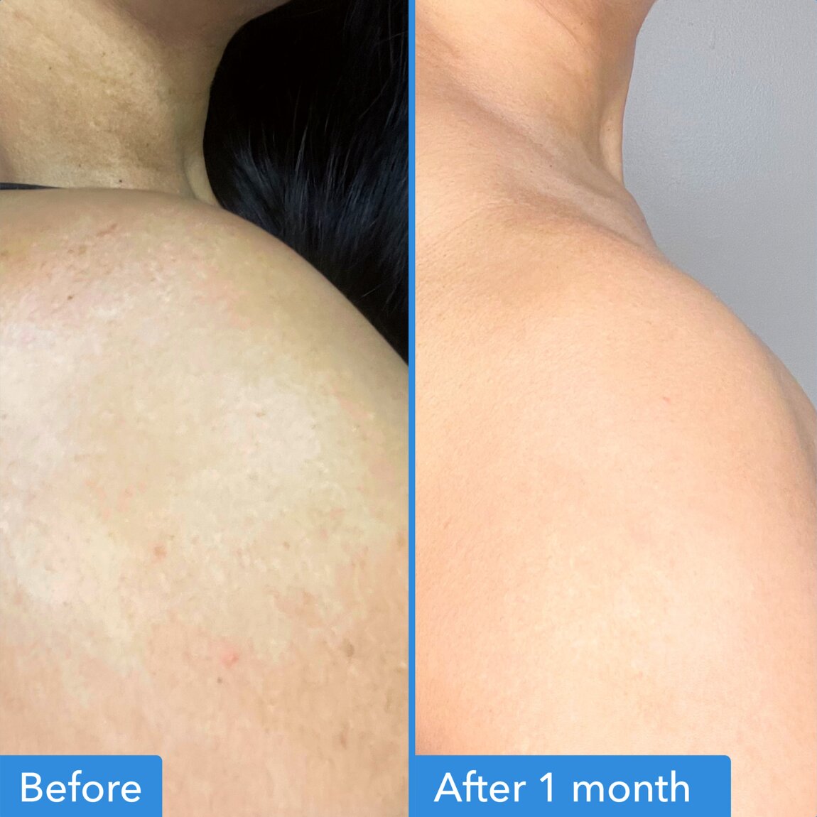 discoloration-correcting-body-treatment-g3 zb_p.jpg