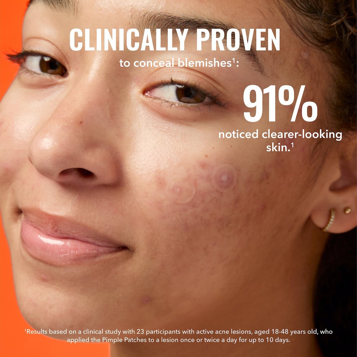 pimple-patches-b8 zb_p.jpg